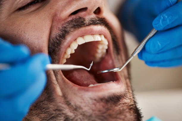 Professional Emergency Dental Service in WI